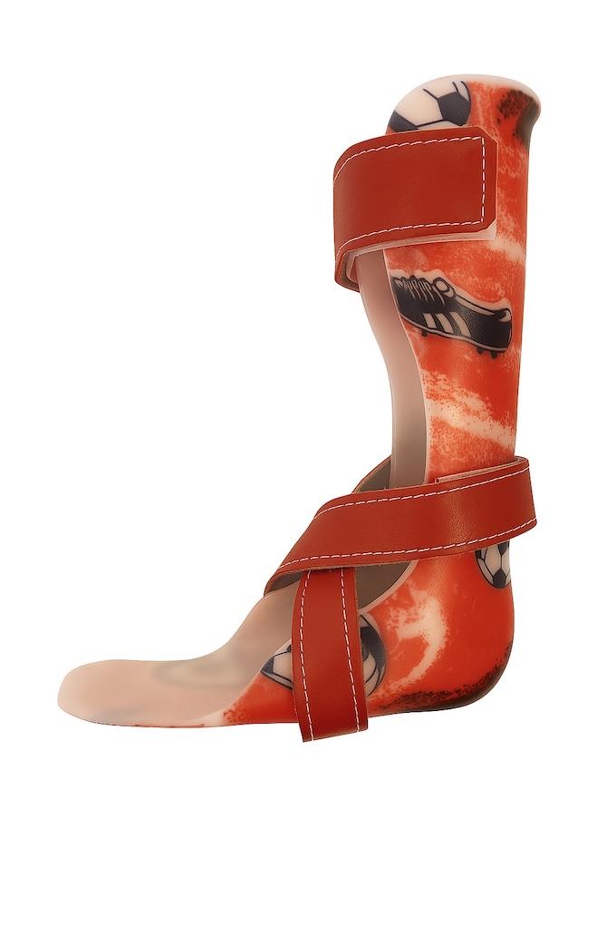 Custom red AFO ankle-foot orthosis