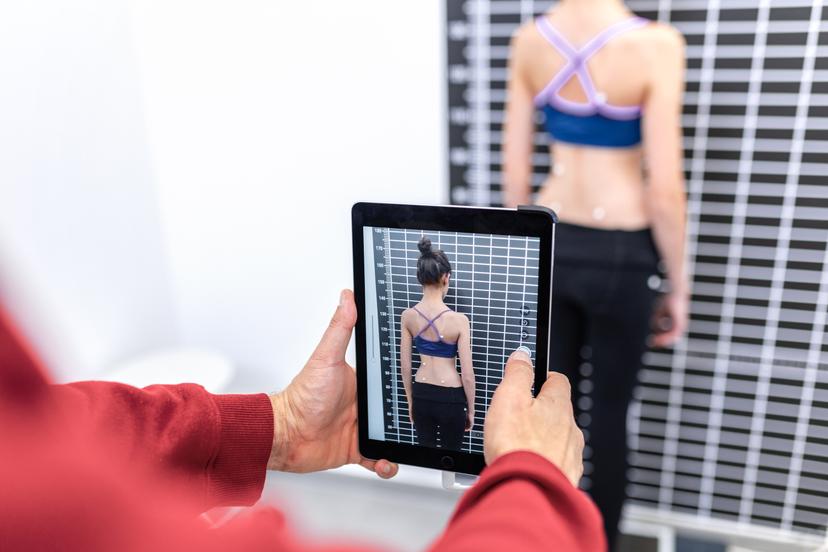 Patient wearing NeJa RSC Rigo Chêneau scoliosis brace