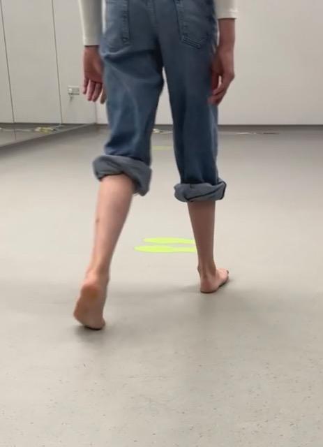 Gait Analysis - Posterior View